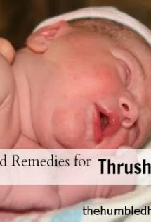 Symptoms and Remedies for Thrush