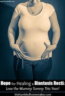Do you look pregnant even though you aren't? Are you years past pregnancy but still have a mummy tummy? If so, you might be dealing with a true medical condition called a diastasis recti. And you are not alone.