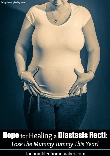 There is hope for healing a diastasis recti! You can lose the mummy tummy!